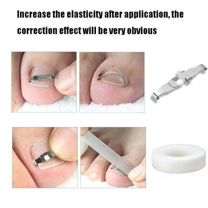 Orthopedic Buckle Toe Nail Groove Ingrown Nail Corrector, Style:No. 42, Specifications:Set - Corrector by buy2fix | Online Shopping UK | buy2fix